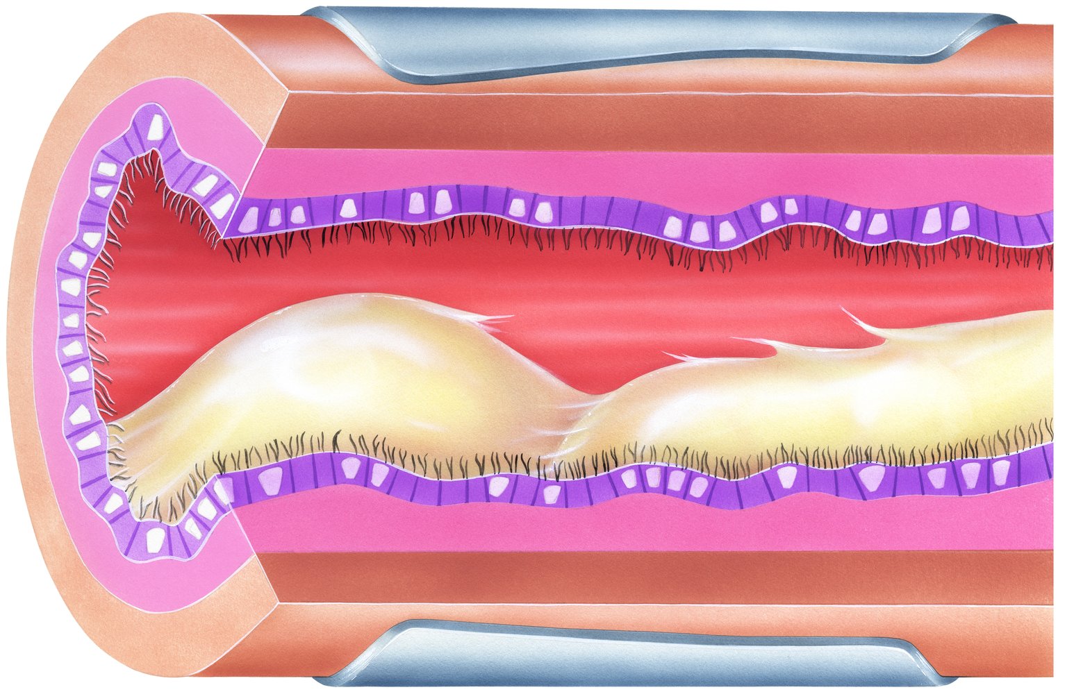 the-easy-way-to-expel-mucus-for-copd-patients